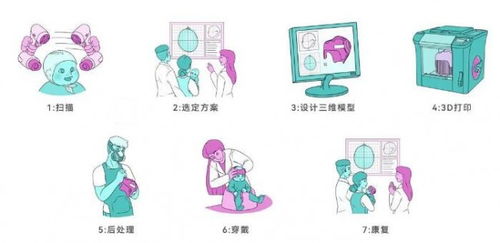 三种康复辅具3d打印材料及其应用
